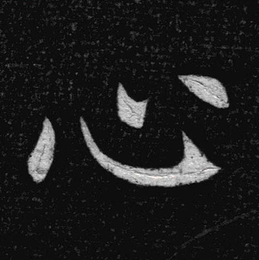 心